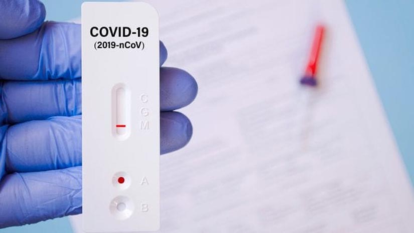 Експрес-тести на COVID-19 тепер можна зробити в закладах первинної меддопомоги - НСЗУ